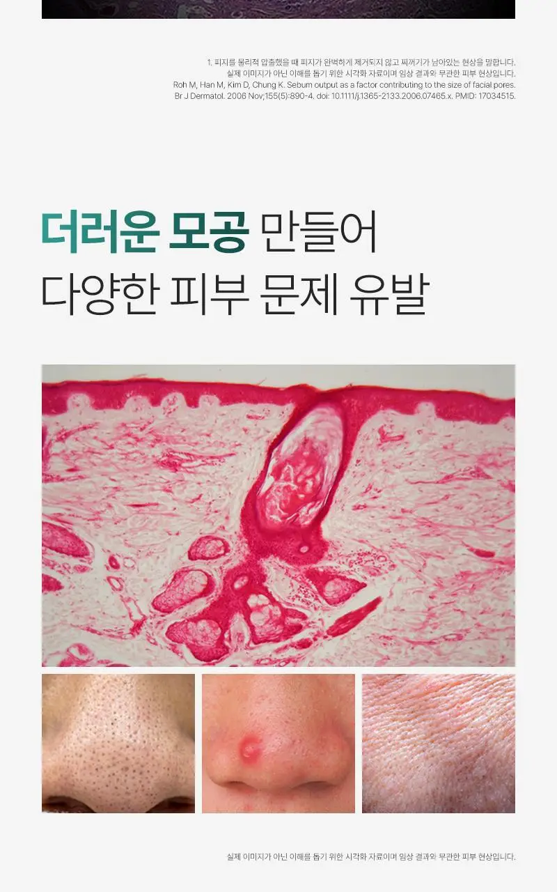 [4중 모공 개선/병풀추출물 7,793ppm] 피캄 포시카 앰플 30ml 상세페이지 5